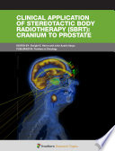Clinical Application of Stereotactic Body Radiotherapy (SBRT): Cranium to Prostate [E-Book] /