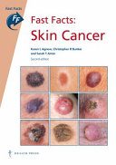 Fast Facts: Skin Cancer [E-Book] /