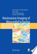 Noninvasive Imaging of Myocardial Ischemia [E-Book] /
