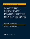 Magnetic resonance imaging of the brain and spine. 1 /