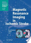 Magnetic Resonance Imaging in Ischemic Stroke [E-Book] /