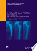 Revision of Loose Femoral Prostheses [E-Book] : With a Stem System Based on the “Press-Fit” Principle: A Concept and a System of Implants: A Method and Its Results /