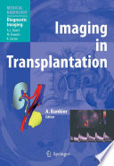 Imaging in Transplantation [E-Book] /