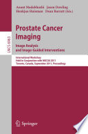 Prostate Cancer Imaging. Image Analysis and Image-Guided Interventions [E-Book] : International Workshop, Held in Conjunction with MICCAI 2011, Toronto, Canada, September 22, 2011. Proceedings /