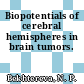 Biopotentials of cerebral hemispheres in brain tumors.