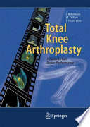 Total Knee Arthroplasty [E-Book] : A Guide to Get Better Performance /