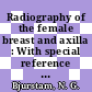 Radiography of the female breast and axilla : With special reference to diagnosis of mammary carcinoma.