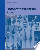 Endoprothesenatlas KNIE [E-Book] /