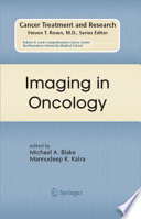 Imaging in Oncology [E-Book] /