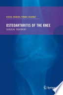 Osteoarthritis of the knee [E-Book] /