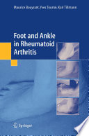 Foot and ankle in rheumatoid arthritis [E-Book] /