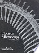 Electron microscopy : principles and techniques for biologists /