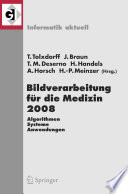 Bildverarbeitung für die Medizin 2008 [E-Book] : Algorithmen — Systeme — Anwendungen Proceedings des Workshops vom 6. bis 8. April 2008 in Berlin /