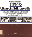 Tumor-Ultraschalldiagnostik : ein Atlas zur Diagnose, Differentialdiagnose und Verlaufskontrolle in Klinik und Praxis /