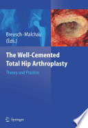 The Well-Cemented Total Hip Arthroplasty [E-Book] : Theory and Practice /