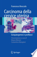 Carcinoma della cervice uterina [E-Book] : Eziopatogenesi e profilassi /