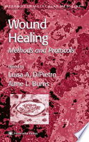 Wound Healing [E-Book] : Methods and Protocols /