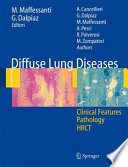 Diffuse Lung Diseases [E-Book] : Clinical Features, Pathology, HRCT /