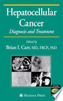 Hepatocellular Cancer [E-Book] : Diagnosis and Treatment /