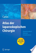 Atlas Laparoskopische Chirurgie [E-Book] /