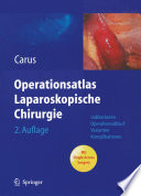 Operationsatlas Laparoskopische Chirurgie [E-Book] /