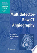 Multidetector-Row CT Angiography [E-Book] /