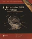 Quantitative MRI of the brain : principles of physical measurement /