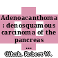 Adenoacanthoma : denosquamous carcinoma of the pancreas : [E-Book]