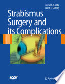 Strabismus Surgery and its Complications [E-Book] /