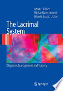 The Lacrimal System [E-Book] : Diagnosis, Management, and Surgery /