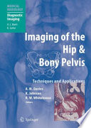 Imaging of the Hip & Bony Pelvis [E-Book] : Techniques and Applications /