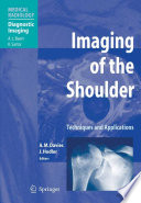 Imaging of the Shoulder [E-Book] : Techniques and Applications /