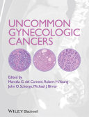 Uncommon gynecologic cancers [E-Book] /