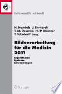 Bildverarbeitung für die Medizin 2011 [E-Book] : Algorithmen - Systeme - Anwendungen Proceedings des Workshops vom 20. - 22. März 2011 in Lübeck /