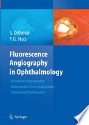 Fluorescence Angiography in Ophthalmology [E-Book] /