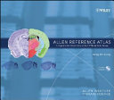 Allen reference atlas : a digital color brain atlas of the C57black/6J male mouse /