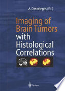 Imaging of brain tumors with histological correlations /