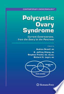 Polycystic Ovary Syndrome [E-Book] : Current Controversies, From The Ovary To The Pancreas /