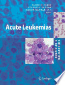 Acute Leukemias [E-Book] /