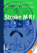 Stroke MRI : 13 tables /