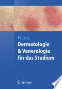 Dermatologie und Venerologie für das Studium [E-Book] /