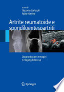 Artrite reumatoide e spondiloentesoartriti [E-Book] : Diagnostica per immagini e imaging follow-up /