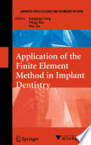 Application of the Finite Element Method in Implant Dentistry [E-Book] /