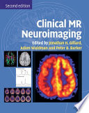 Clinical MR neuroimaging : physiological and functional techniques [E-Book] /