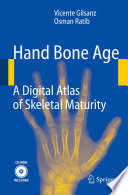 Hand Bone Age [E-Book] : A Digital Atlas of Skeletal Maturity /