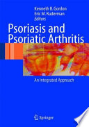 Psoriasis and Psoriatic Arthritis [E-Book] : An Integrated Approach /
