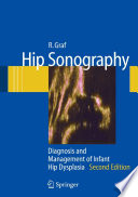 Hip Sonography [E-Book] : Diagnosis and Management of Infant Hip Dysplasia /