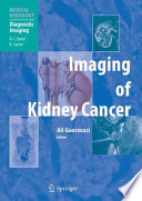 Imaging of Kidney Cancer [E-Book] /