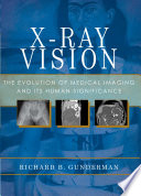 X-ray vision : the evolution of medical imaging and its human significance [E-Book] /