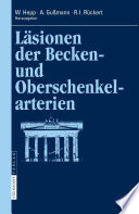 Läsionen der Becken- und Oberschenkelarterien [E-Book] /